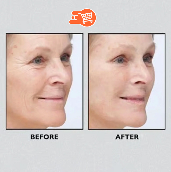 Crema Anti bolsas de agua para ojos