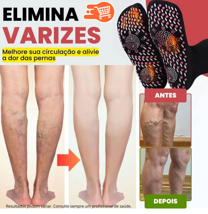 Calcetines de acupresión antivarices