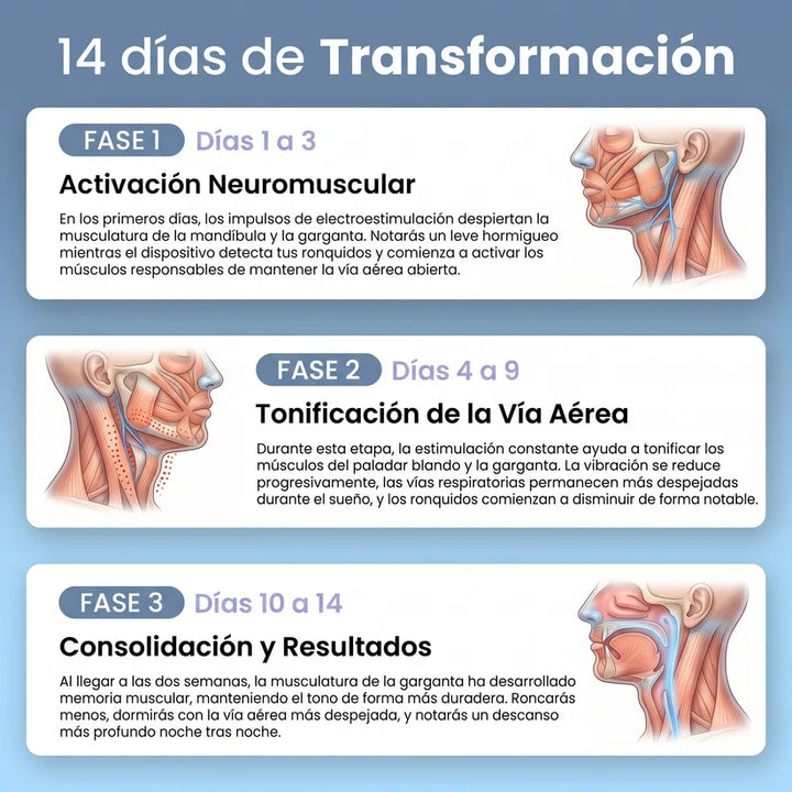 Dispositivo Inteligente Anti-Ronquidos