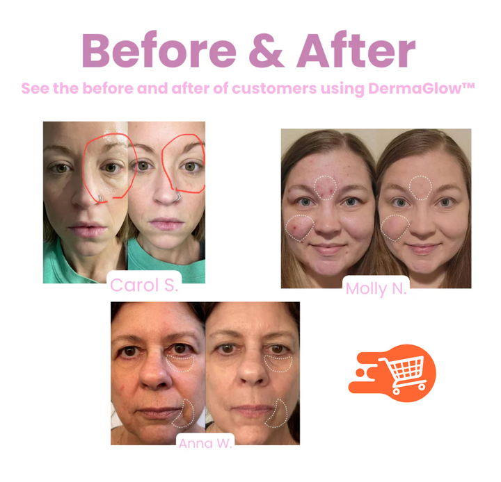 DermaGlow | Elimina líneas finas y arrugas sin esfuerzo